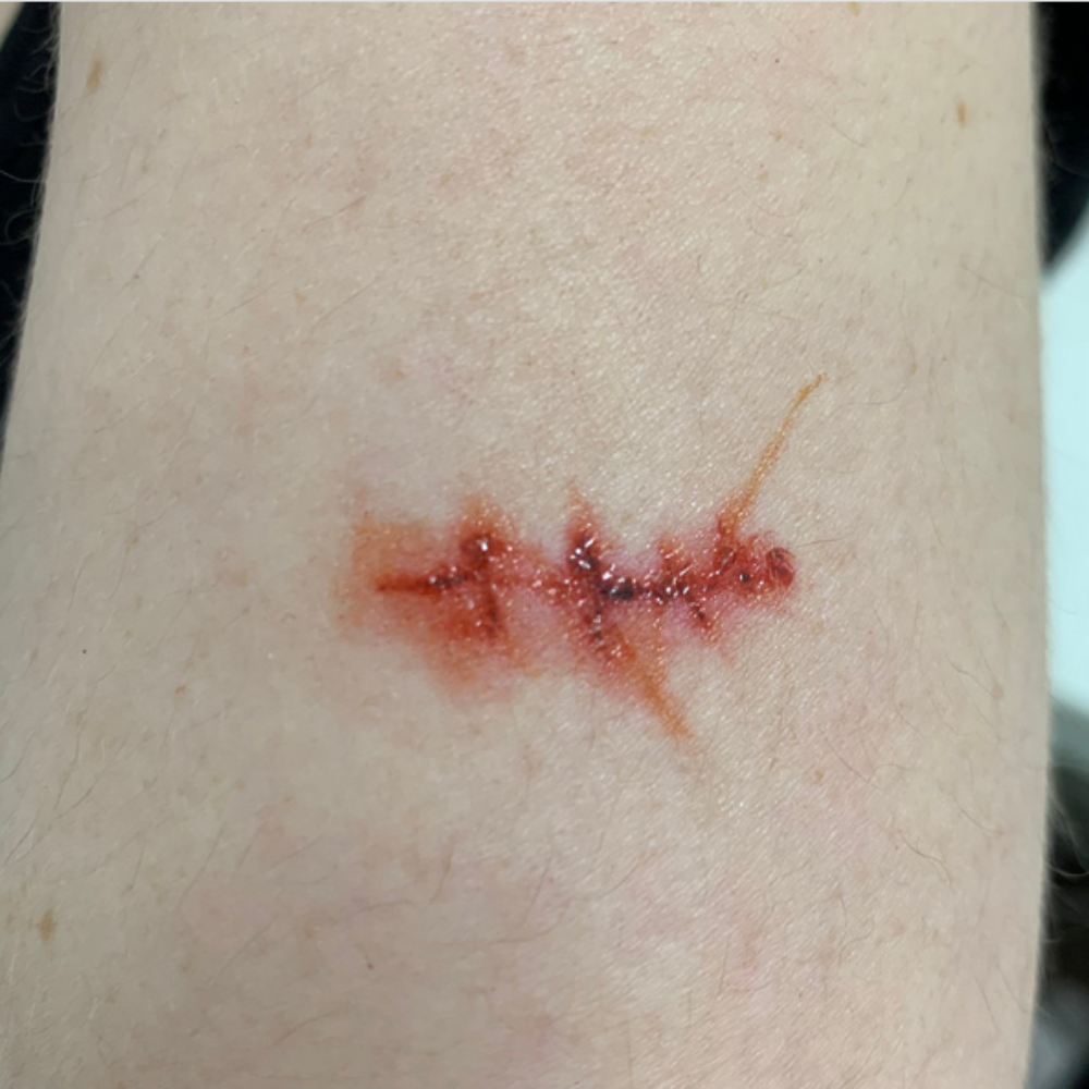 Twilight Creations Tattoo Scars & Sutures 1A