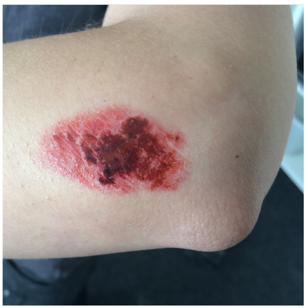 Twilight Creations Skin Scrapes 1