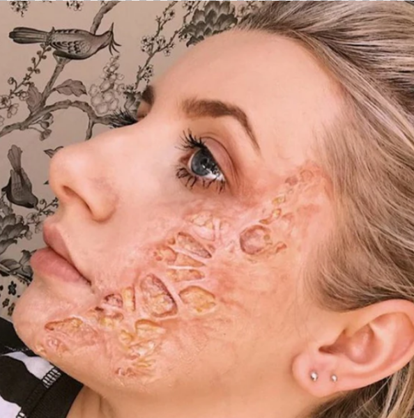 Rotting Flesh Wound Set