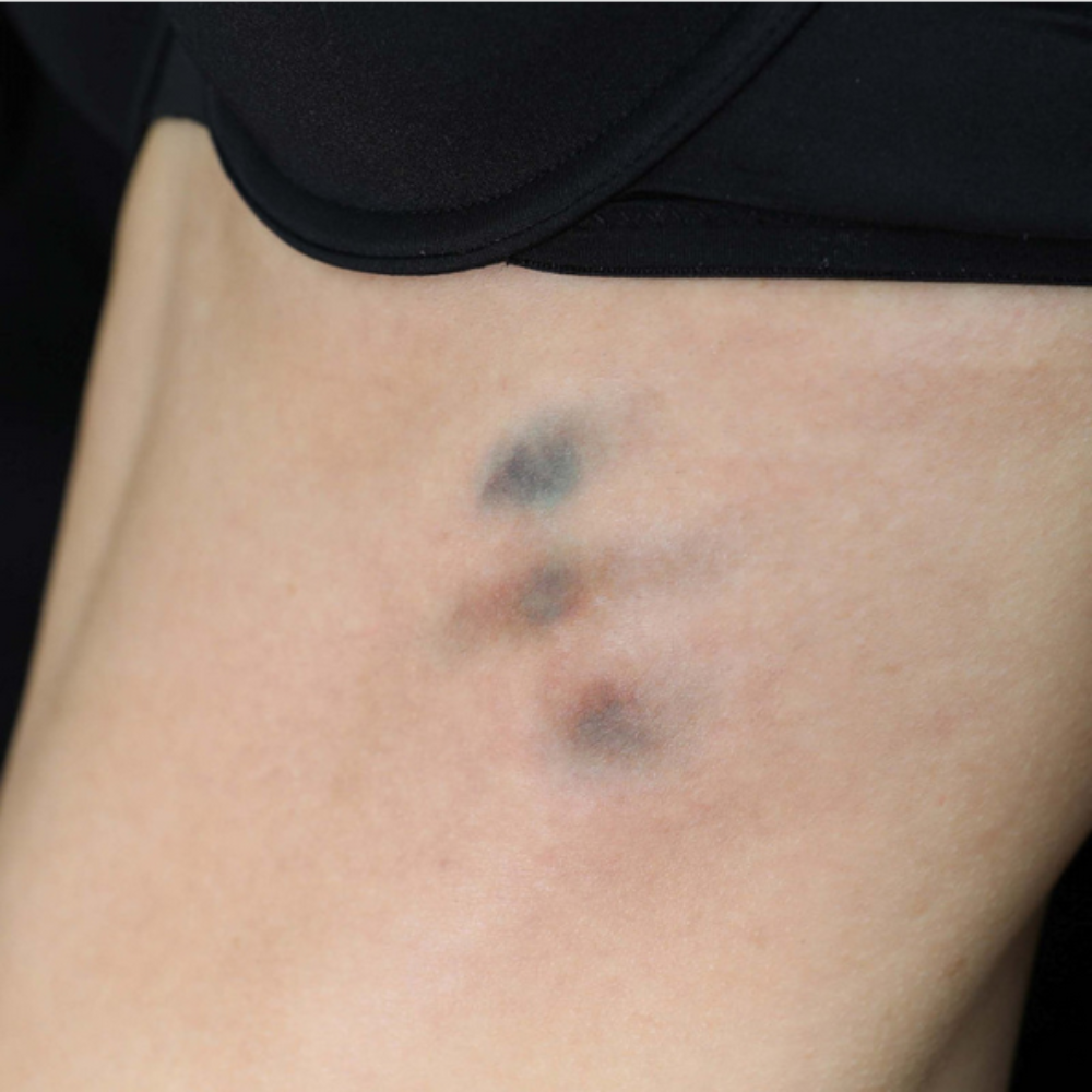 Twilight Creations Tattoo Bruises 2C