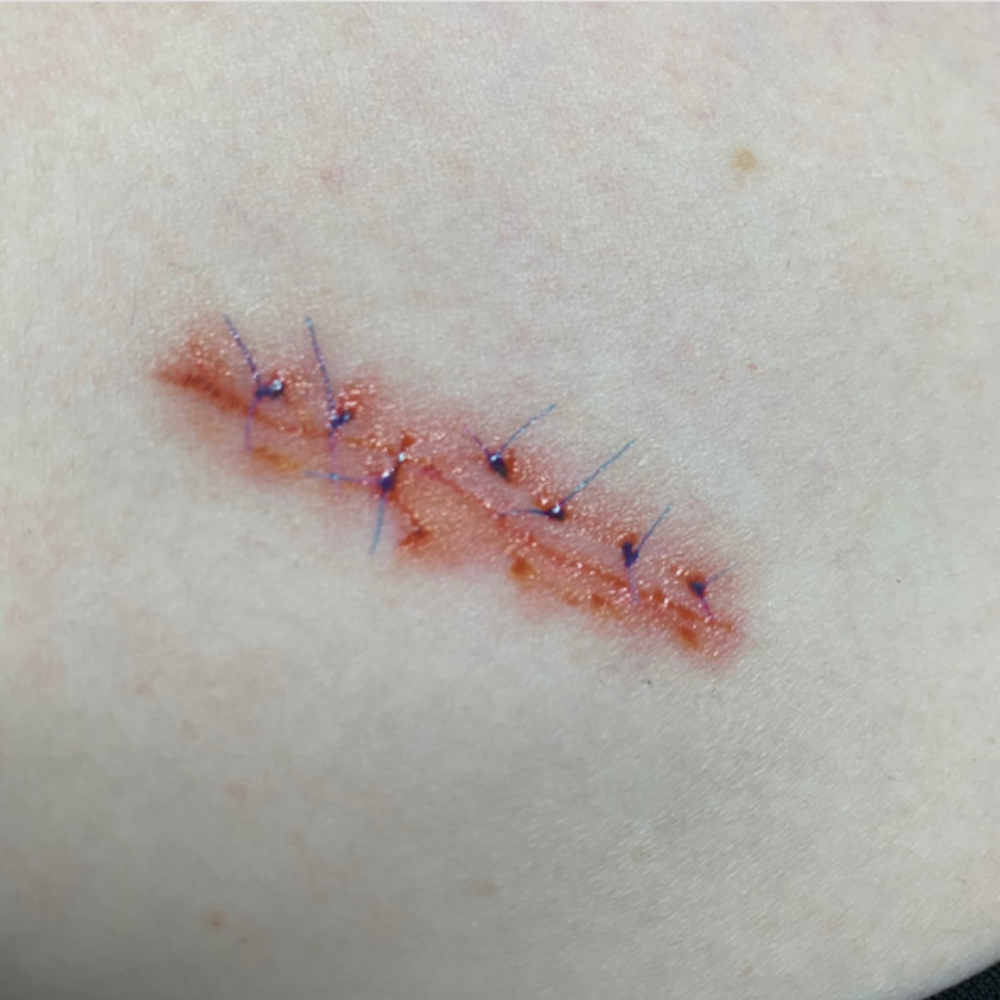 Twilight Creations Tattoo Scars & Sutures 1A